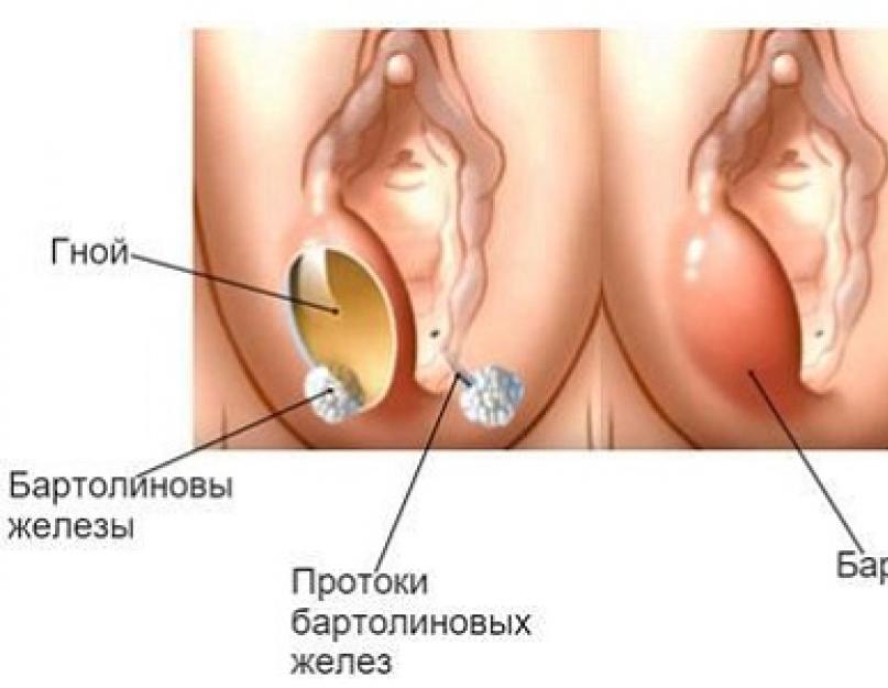 Бартолинит.jpg Бартолинит.jpg