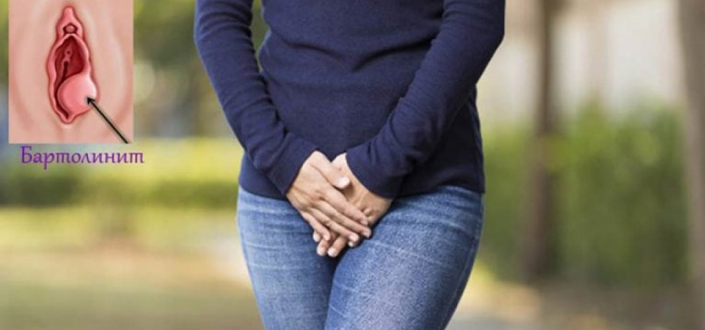 Бартолинит 2.png