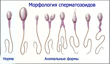 Морфология сперматозоидов