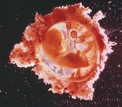 12 недель беременности